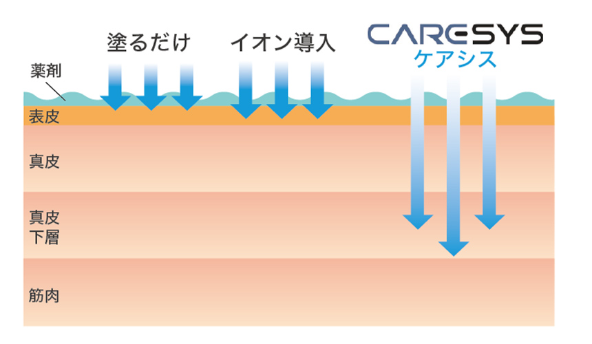 ケアシスの特徴