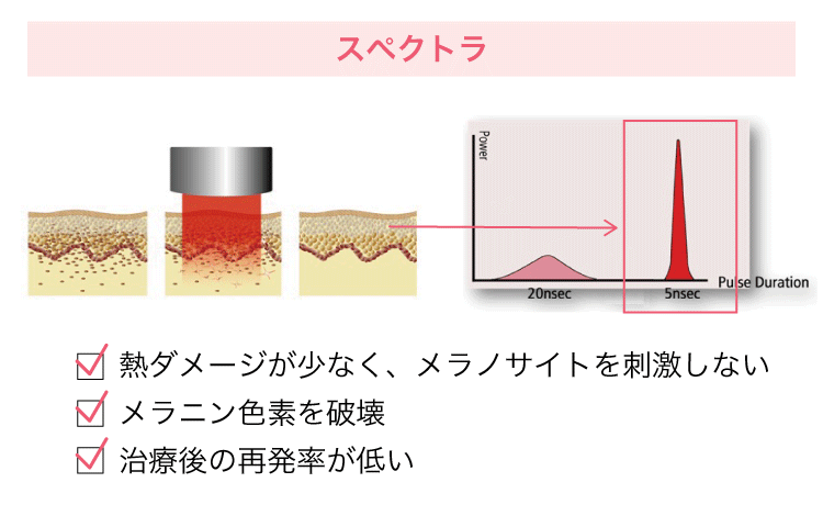 スペクトラ