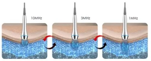 周波数により深達度が異なります